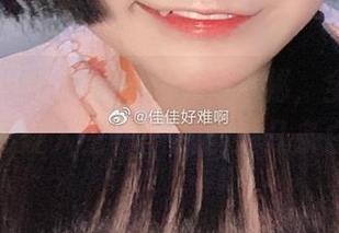 佳佳好难啊的白裙图集大揭秘，全套美图让我怀疑人生——我该买几条白裙？